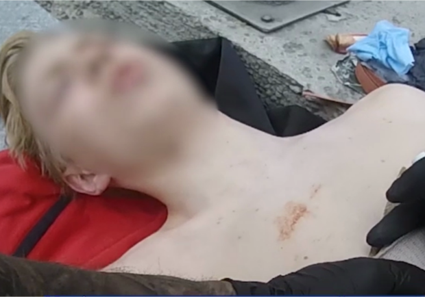 В центре Киева подросток упал с электросамоката на штырь. Фото: скрин с видео Патрульной полиции Киева