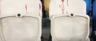Драка на матче "Динамо-Александрия": полиция открыла уголовное производство