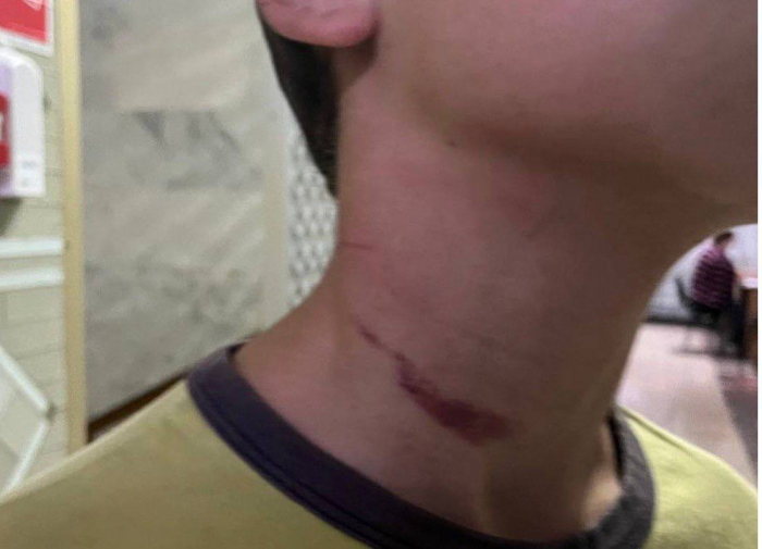В Киевской области мужчина пытался задушить кабелем своего 12-летнего пасынка.