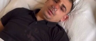 В Киеве произошла потасовка с участием нардепов