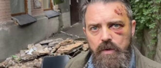 В Киеве на американца упал балкон - КМВА