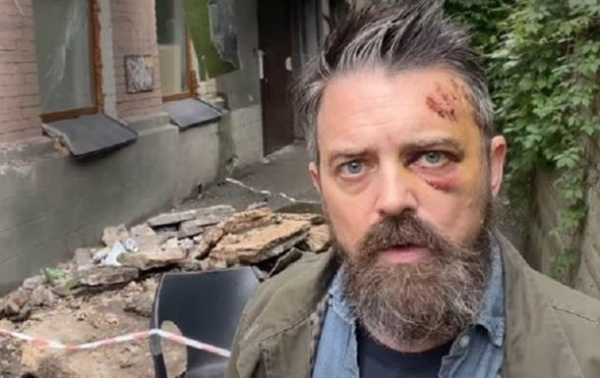 В Киеве на американца упал балкон - КМВА