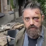 В Киеве американский режиссер вышел на балкон, а тот обрушился