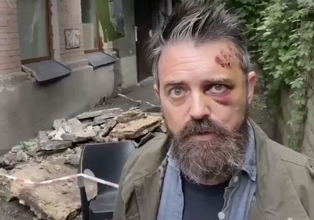 В Киеве на американца упал балкон у подъезда многоэтажки. фото из соцсетей