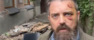 Під американським журналістом в Києві обвалився балкон