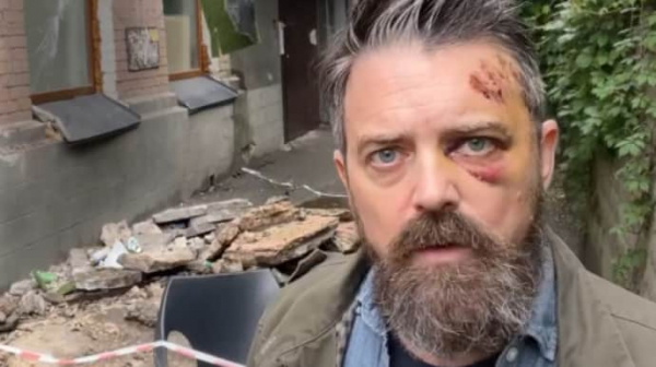 Під американським журналістом в Києві обвалився балкон