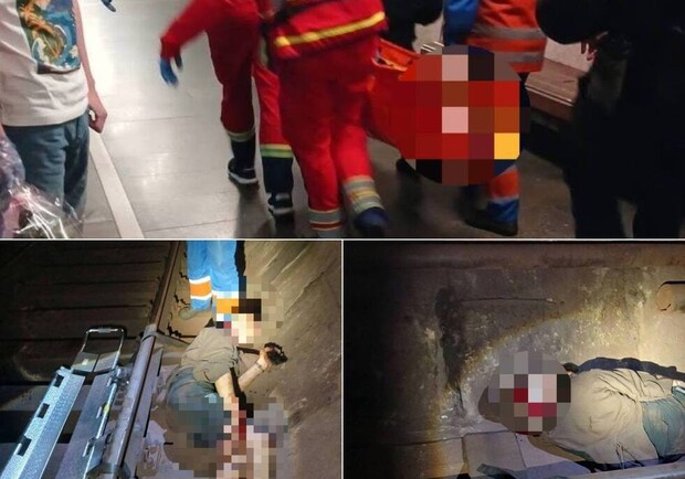 Вместо вирусного видео – перелом ноги и сотрясение мозга: в киевском метрополитене едва не погиб 19-летний блоггер 