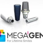 5 питань про імпланти MegaGen: все, що варто знати