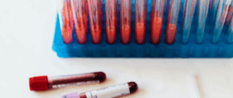 Обзор современных пробирок для анализа крови Обзор современных пробирок для анализа крови