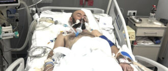 Співак Adam у комі: Міша Клименко бореться з туберкульозним менінгітом