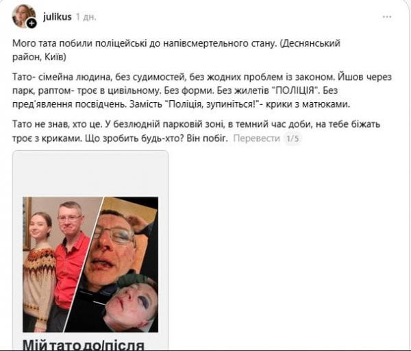 Поліція Києва затримала чоловіка "за непокору": донька заявила про жорстоке побиття батька
Поліція Києва затримала чоловіка "за непокору": донька заявила про жорстоке побиття батька