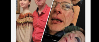 Жорстоке затримання у парку Києва: батько отримав перелом очниці та крововилив у мозок