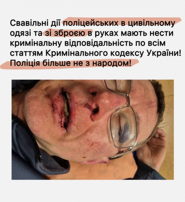 Жорстоке затримання у парку Києва: батько отримав перелом очниці та крововилив у мозок фото 6 5