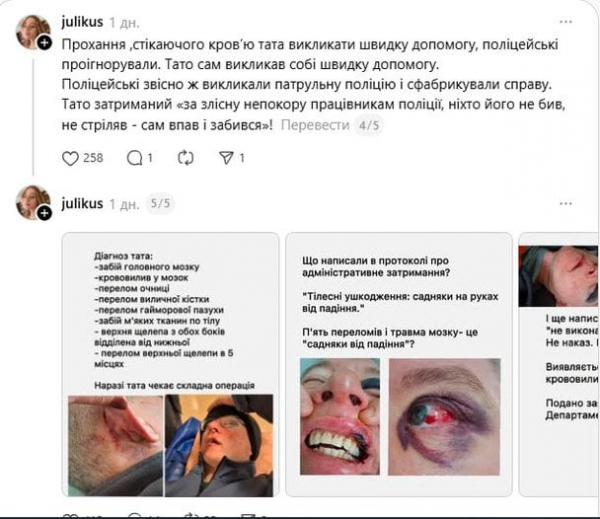 Поліція Києва затримала чоловіка "за непокору": донька заявила про жорстоке побиття батька
Поліція Києва затримала чоловіка "за непокору": донька заявила про жорстоке побиття батька