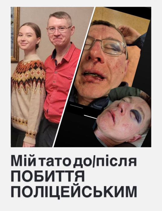 Жорстоке затримання у парку Києва: батько отримав перелом очниці та крововилив у мозок фото 1