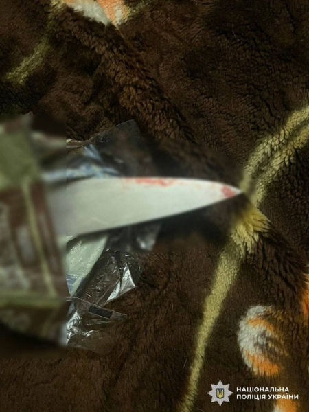 
 Ревнощі до&nbsp;колишньої ледь не&nbsp;призвели до&nbsp;трагедії: у&nbsp;Києві судитимуть чоловіка за&nbsp;напад з&nbsp;ножем
 